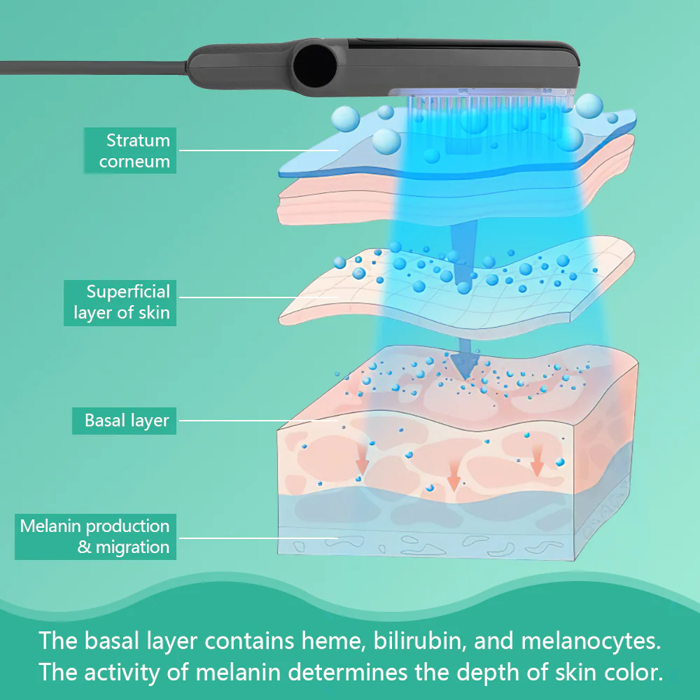 KTS 311nm UVB light therapy treatment for psoriasis vitiligo - Image 5