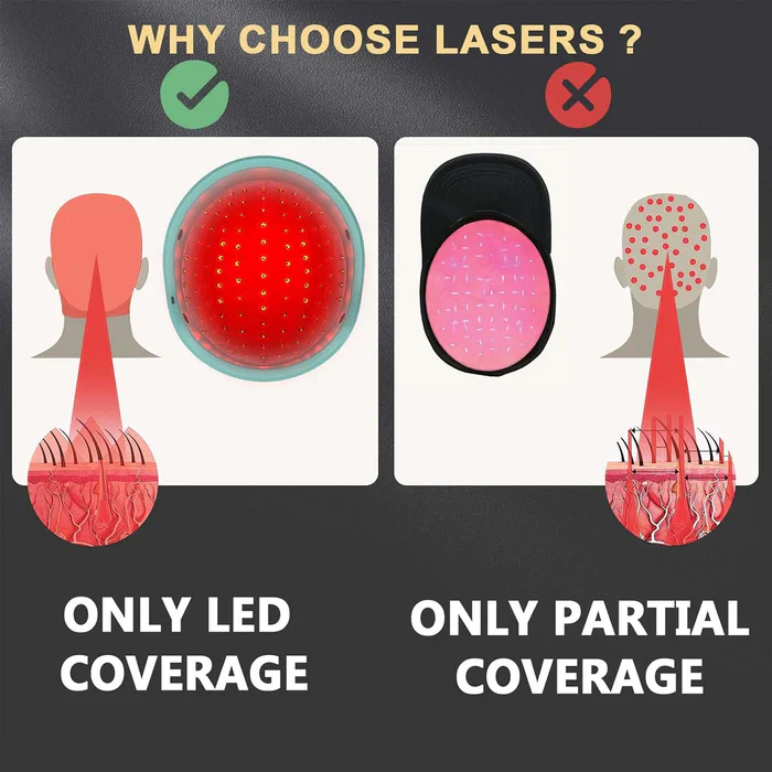 KTS® Hair Regrowth Treatments Laser Cap - Image 6