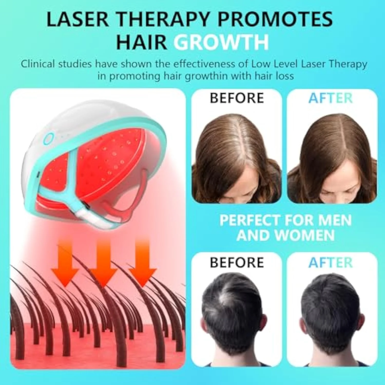 Red Light Helmet For Hair Regrowth（Cordless Device） - Image 4