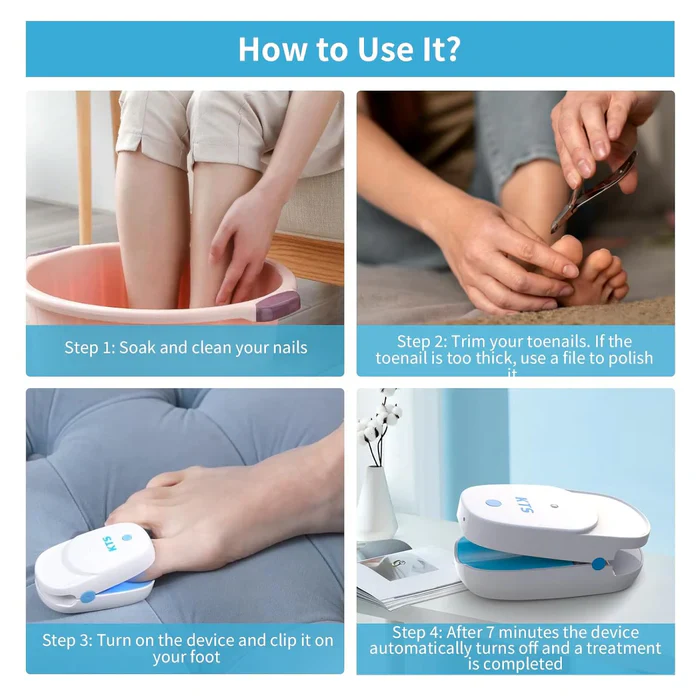 KTS® Nail Fungus Laser Treatment Device Collection - Image 16