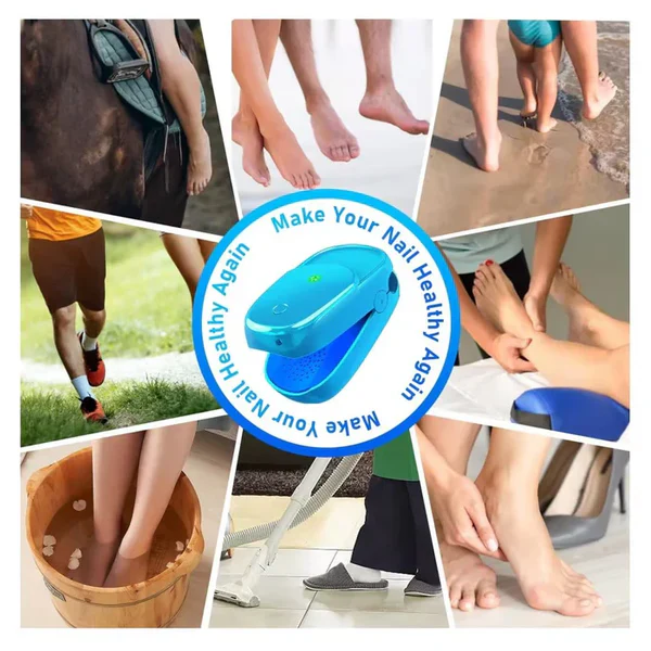KTS® New Onychomycosis Laser Treatment Device - Image 6