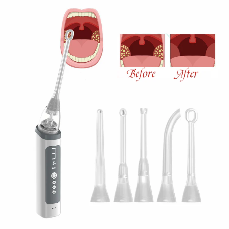 KTS Tonsil Stone Removal Kit with Irrigation Syringe - Image 8